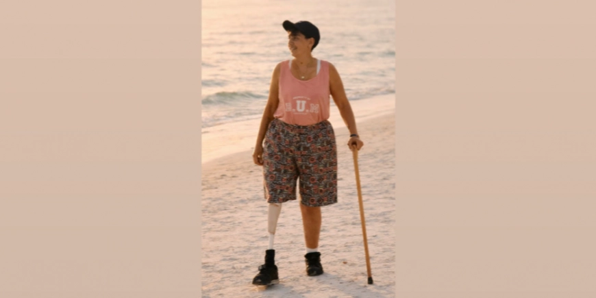 Why Representation Matters in Amputee Support: Understanding Different Experiences After Amputation