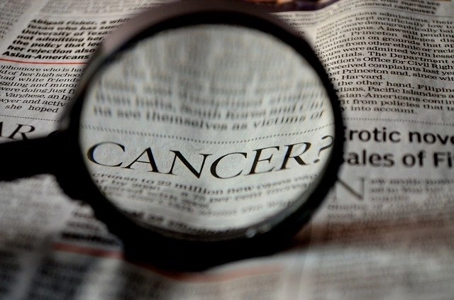 Cholangiocarcinoma: Your Rare Cancer Isn’t So Rare to Us Cholangiocarcinoma: Your Rare Cancer Isn’t So Rare to Us